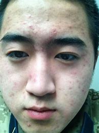 怎么去除手机屏上的广告 屏幕上一直有广告怎么回事？